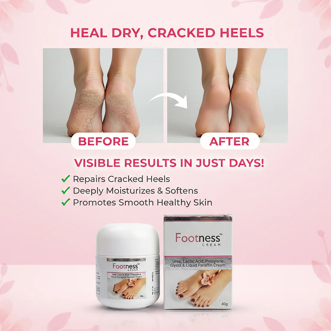 footness cream for repairs cracked heels